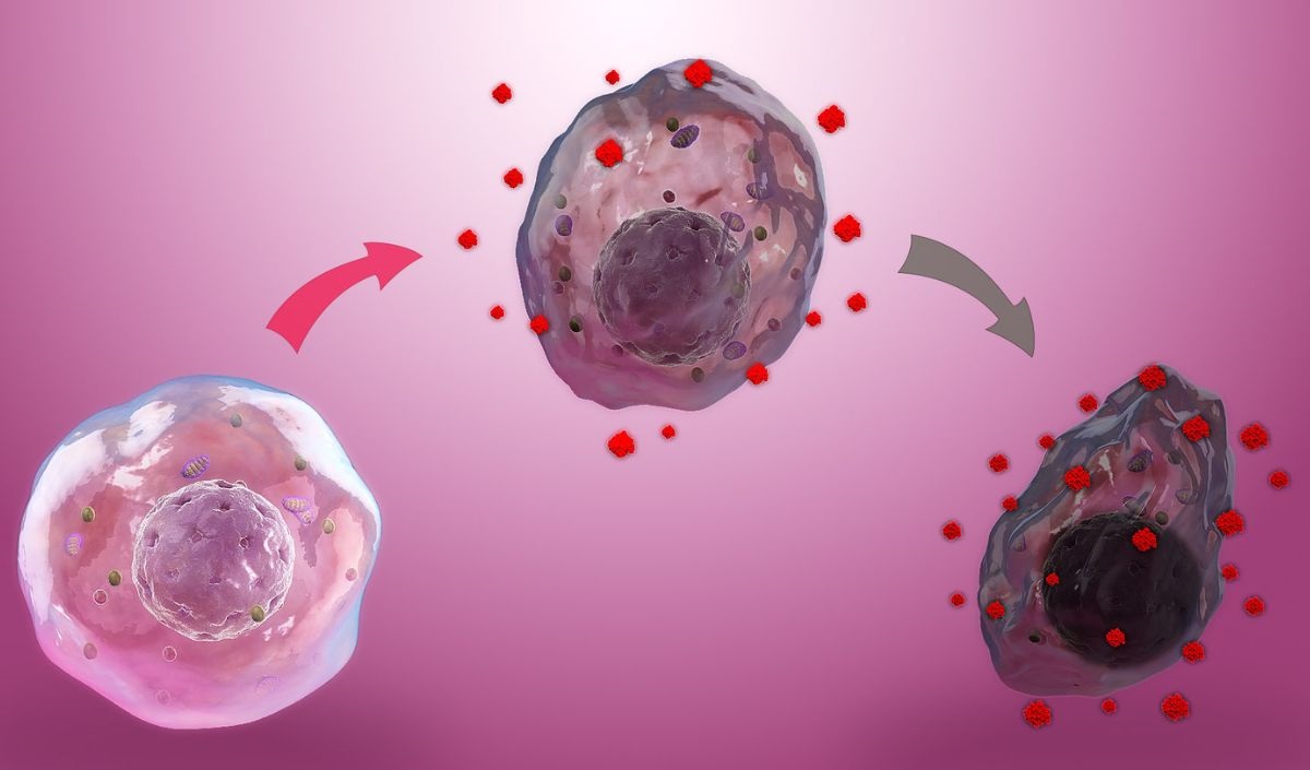 Sebum bị oxy hóa gây stress oxy hóa và duy trì phản ứng viêm trên da dầu mụn