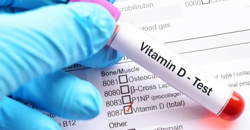 Xét nghiệm 25 hydroxyvitamin D giúp đánh giá tình trạng thiếu vitamin D